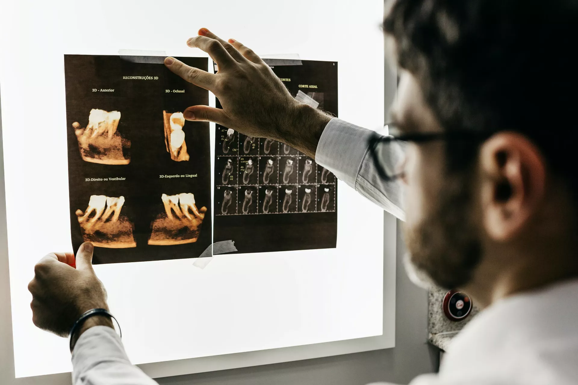 Radiografía de dentista - Sputnik Mundo, 1920, 03.11.2023