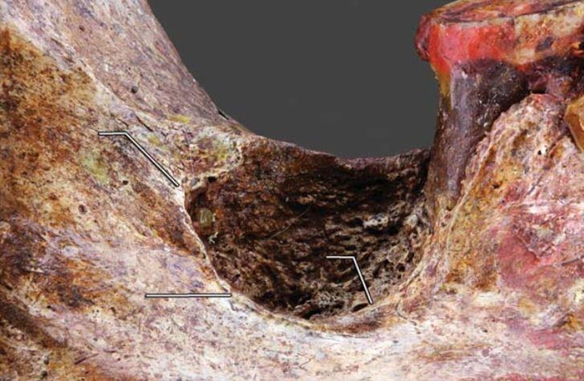 La mandíbula de una mujer del cementerio Oleneostróvsky con indicios de intervenciones quirúrgicas - Sputnik Mundo, 1920, 05.01.2024