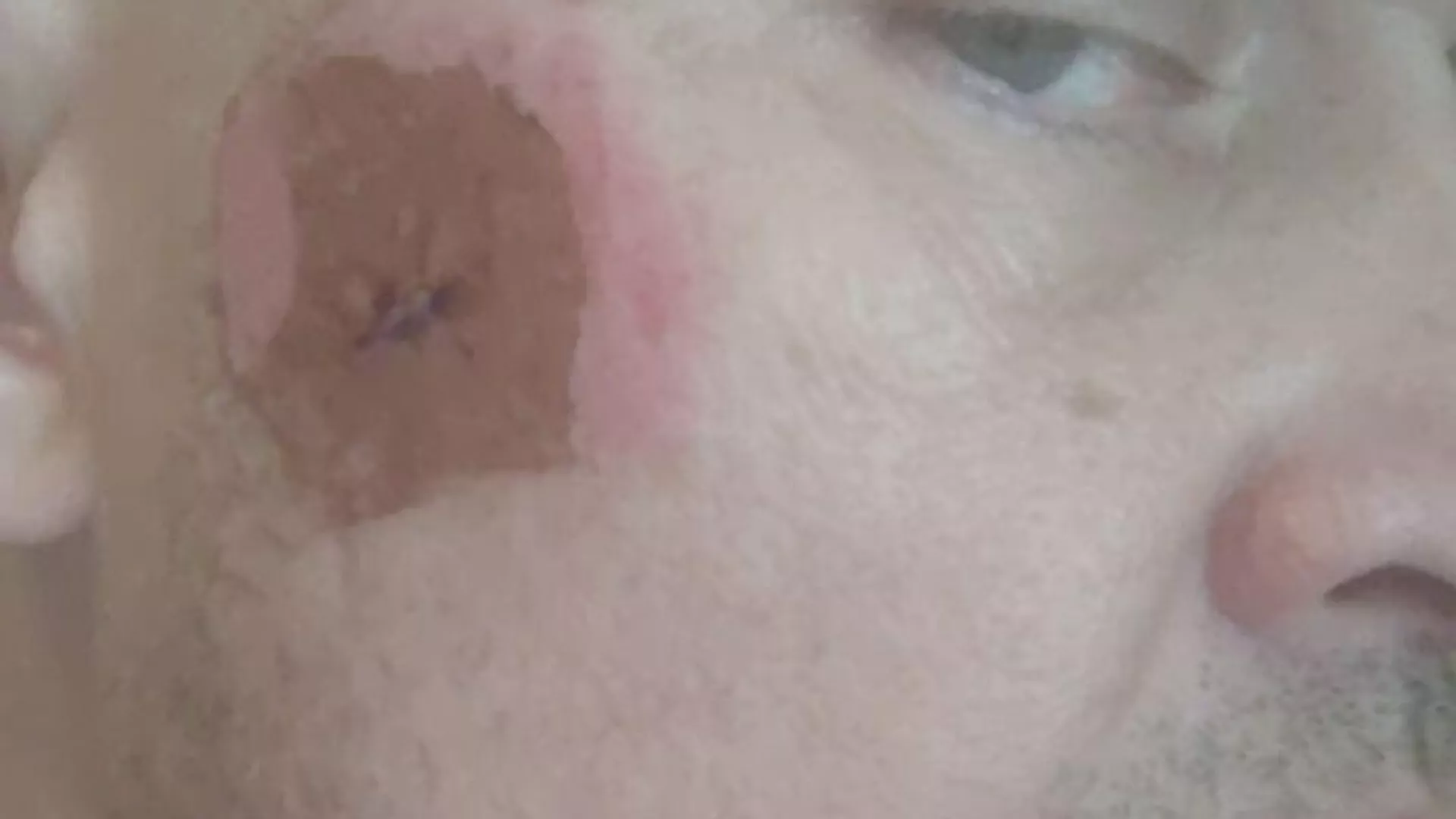 Secuelas del ataque de un dron ucraniano contra el asesor del jefe de la república popular de Donetsk, Yan Gaguin