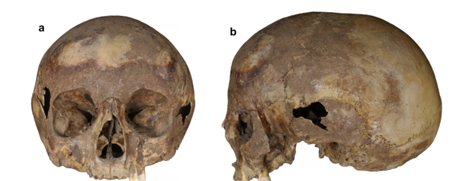 El cráneo del Octógono de Éfeso. - Sputnik Mundo, 1920, 23.01.2025