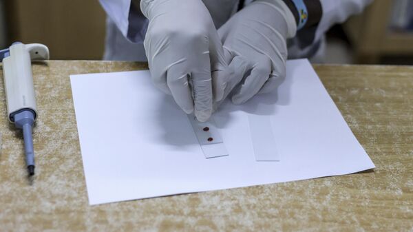 Prueba de malaria - Sputnik Mundo