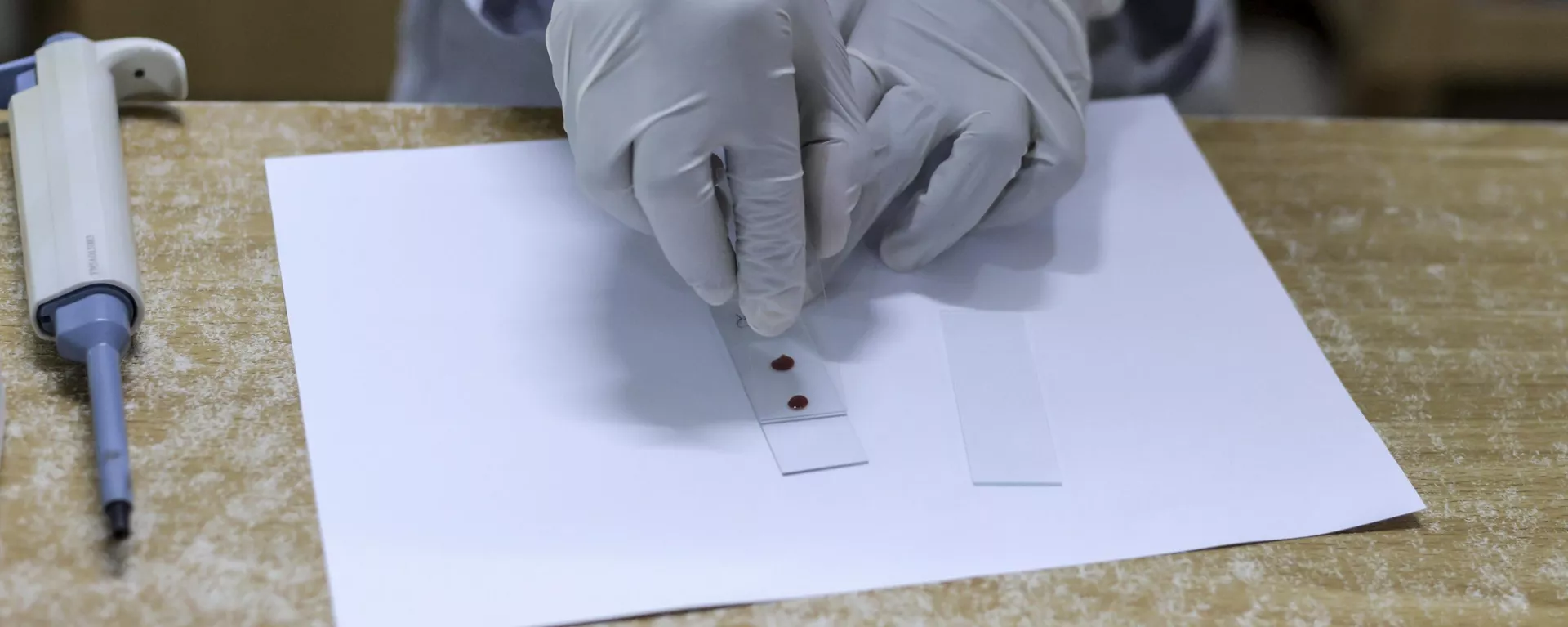 Prueba de malaria - Sputnik Mundo, 1920, 03.07.2025