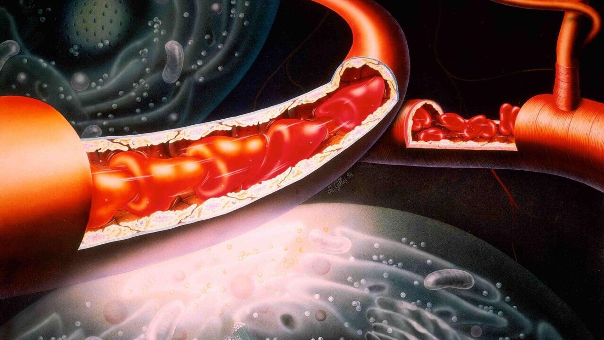 ‍ Científicos rusos descubren cómo ver mejor las venas - Sputnik Mundo, 1920, 08.08.2025