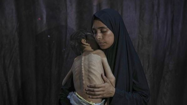 El hambre y la desnutrición en Gaza - Sputnik Mundo