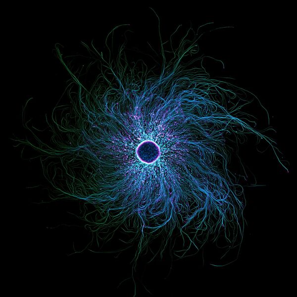 Séptimo puesto: Neuronas sensoriales derivadas de iPSC marcadas para mostrar tubulina y actina de la operadora Stella Whittaker, EEUU. Séptimo puesto: Neuronas sensoriales derivadas de iPSC marcadas para mostrar tubulina y actina de la operadora Stella Whittaker, EEUU. - Sputnik Mundo