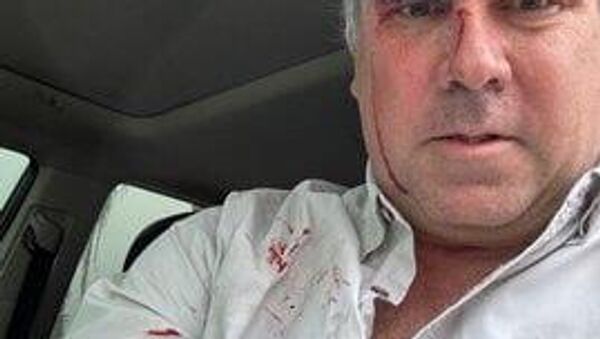 El precandidato presidencial de Perú es herido tras un ataque a tiros - Sputnik Mundo