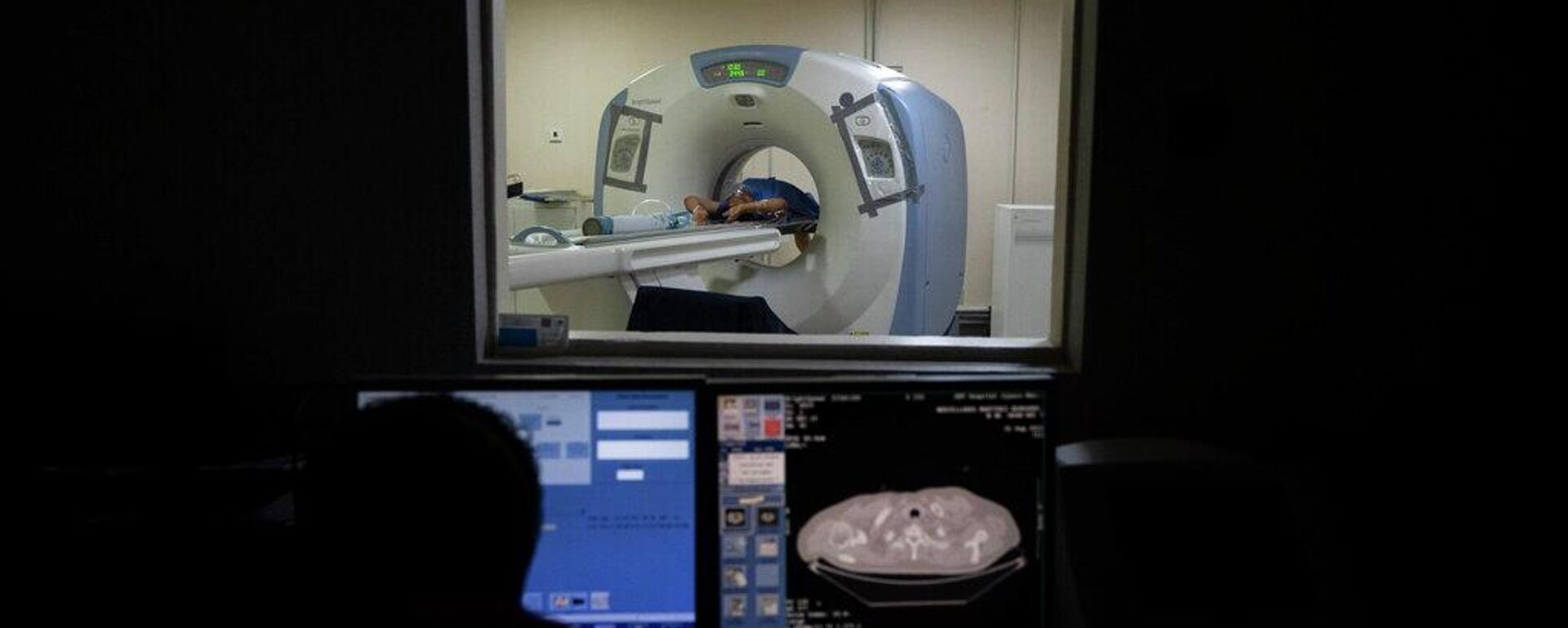 Gobierno de México compra más de 800 equipo de alta tecnología para el sector salud - Sputnik Mundo, 1920, 28.01.2026