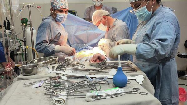 Operación de corazón en Bolivia - Sputnik Mundo