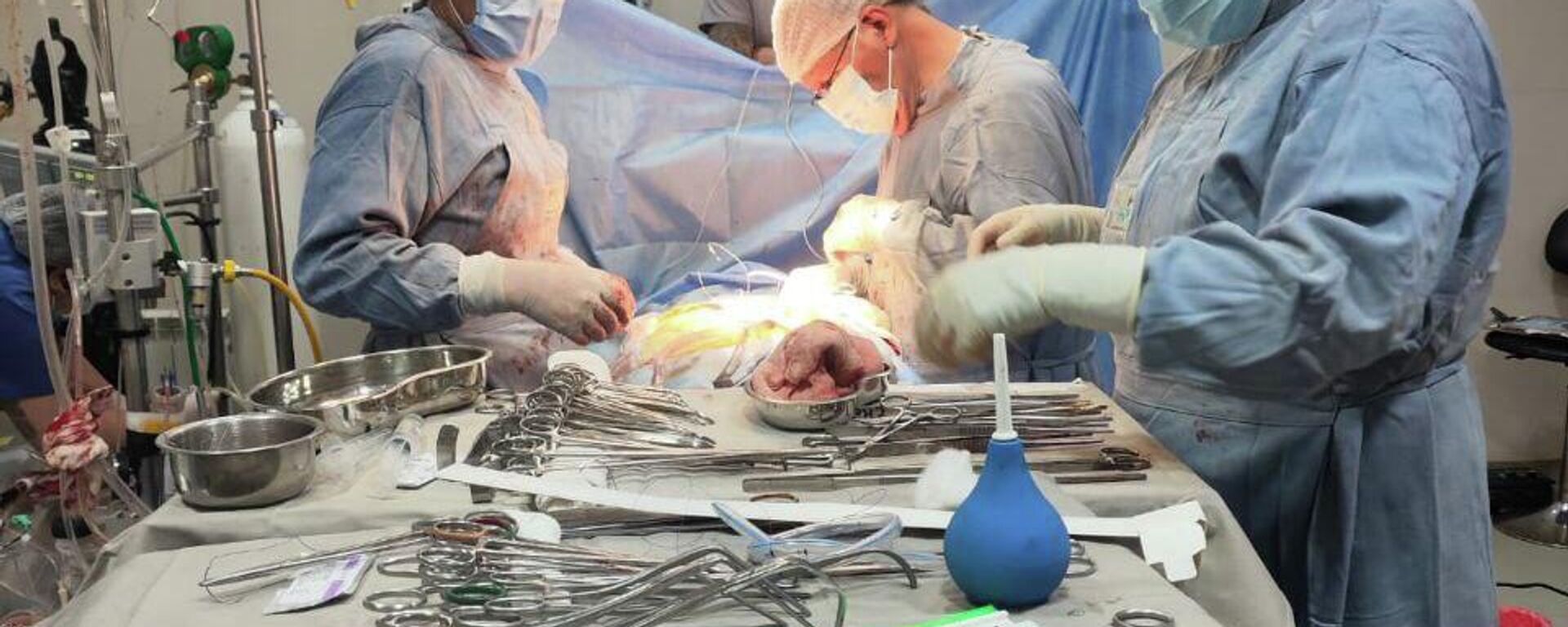 Operación de corazón en Bolivia - Sputnik Mundo, 1920, 31.01.2026