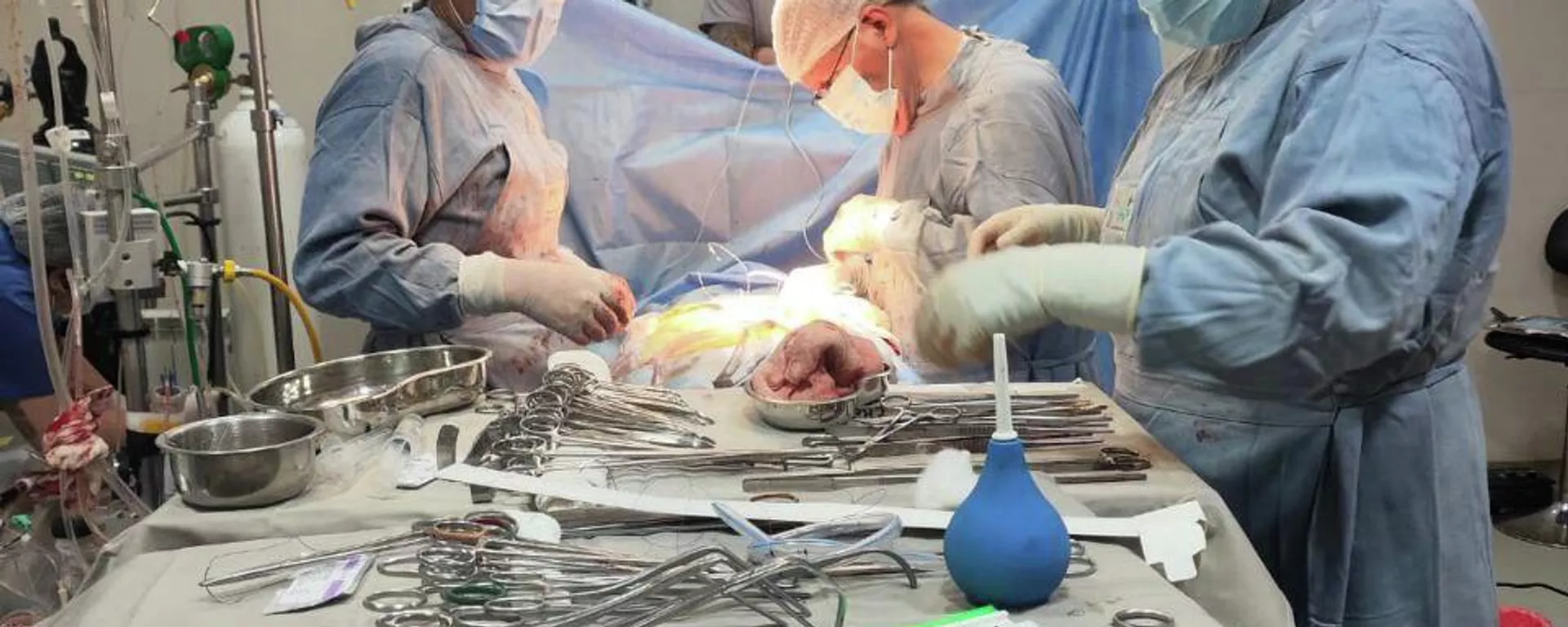 Operación de corazón en Bolivia - Sputnik Mundo, 1920, 31.01.2026