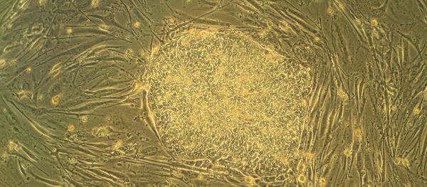 Células madre Células madre - Sputnik Mundo