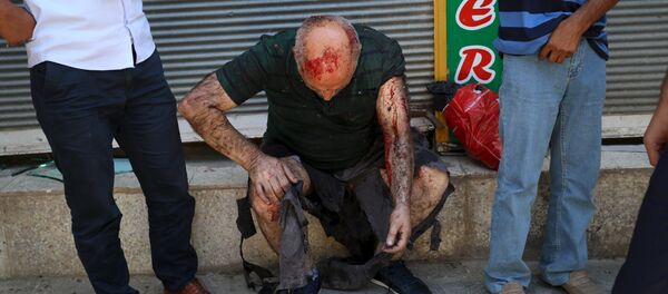 Un hombre herido en el atentado de Suruc Un hombre herido en el atentado de Suruc - Sputnik Mundo