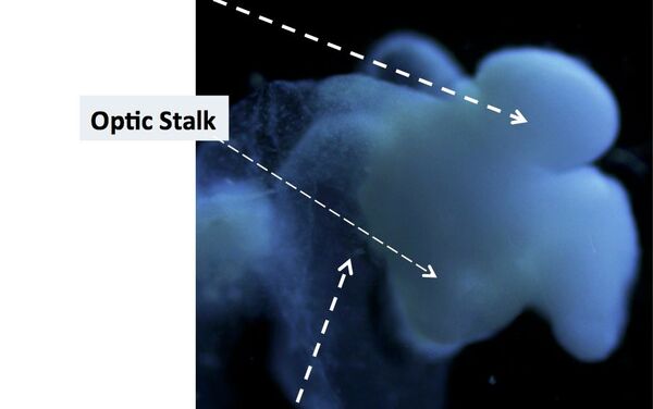 Científicos de EEUU cultivan un cerebro humano - Sputnik Mundo
