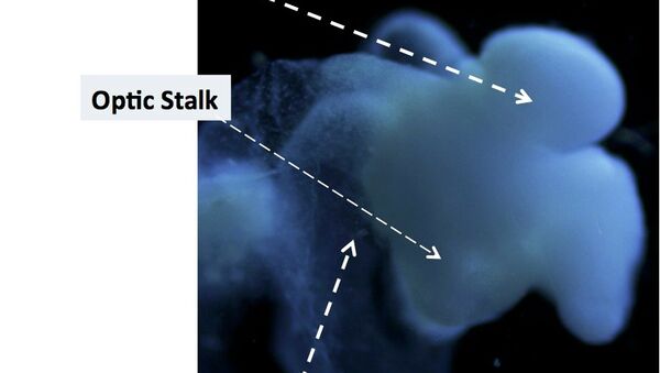 Científicos de EEUU cultivan un cerebro humano - Sputnik Mundo