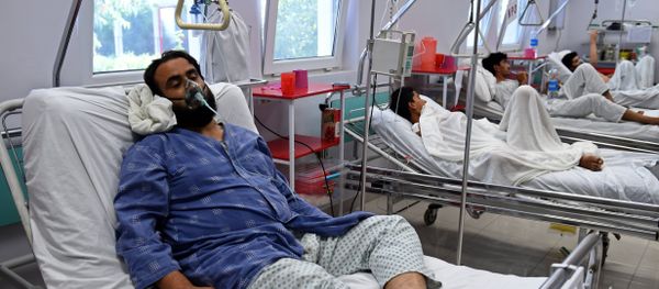 Um membro da MSF ferido durante ataque aéreo dos EUA no hospital em Kunduz recebe tratamento em Cabul, Afeganistão Um membro da MSF ferido durante ataque aéreo dos EUA no hospital em Kunduz recebe tratamento em Cabul, Afeganistão - Sputnik Mundo