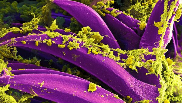 La enterobacteria Yersinia pestis - Sputnik Mundo