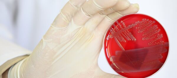 Colonias de bacterias E.Coli - Sputnik Mundo