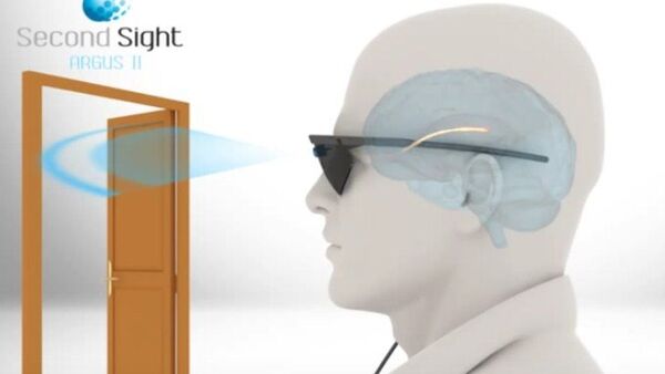 Implante de visión artificial Argus II - Sputnik Mundo