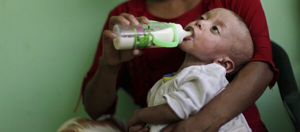 Desnutrición - Sputnik Mundo