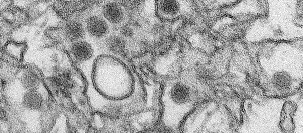 Virus de Zika bajo un microscopio - Sputnik Mundo