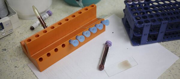 Hallan pruebas en EEUU de que el zika está relacionado con la microcefalia - Sputnik Mundo