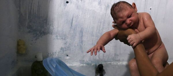 Niño brasileño con microcefalia - Sputnik Mundo