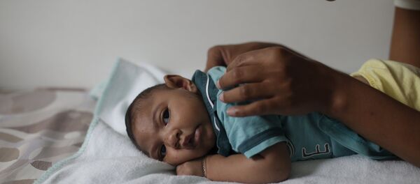 Bebé con microcefalia - Sputnik Mundo