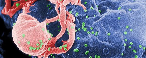 VIH-1 en liberación (en verde) en un cultivo de linfocitos - Sputnik Mundo