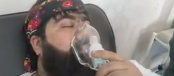 Una víctima de ataque químico a Alepo - Sputnik Mundo