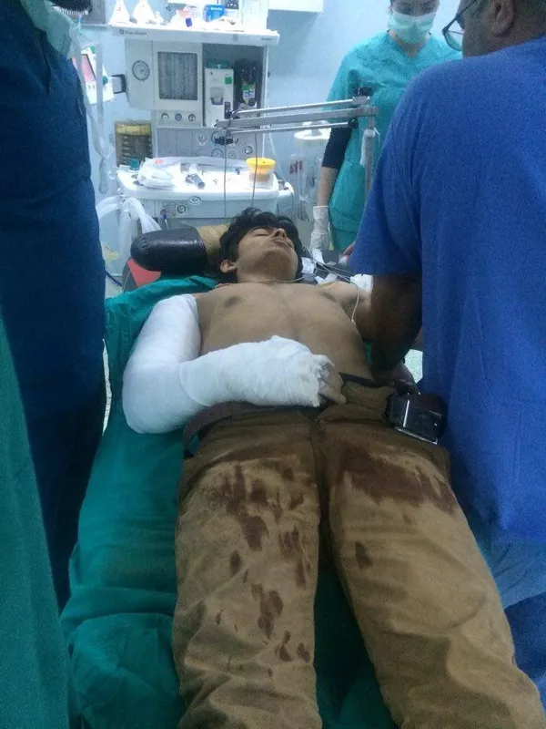 Combatiente de Daesh en el hospital turco Ersin Arslan Combatiente de Daesh en el hospital turco Ersin Arslan - Sputnik Mundo