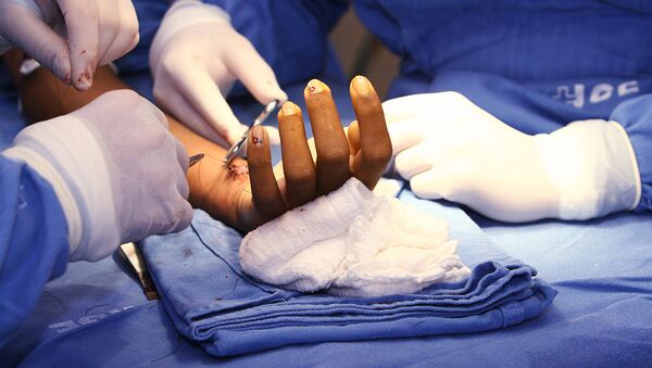 Una operación quirúrgica en Brasil Una operación quirúrgica en Brasil - Sputnik Mundo