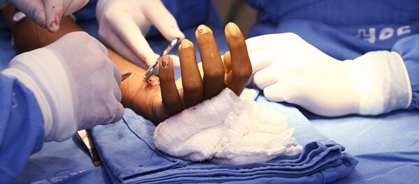Una operación quirúrgica en Brasil - Sputnik Mundo