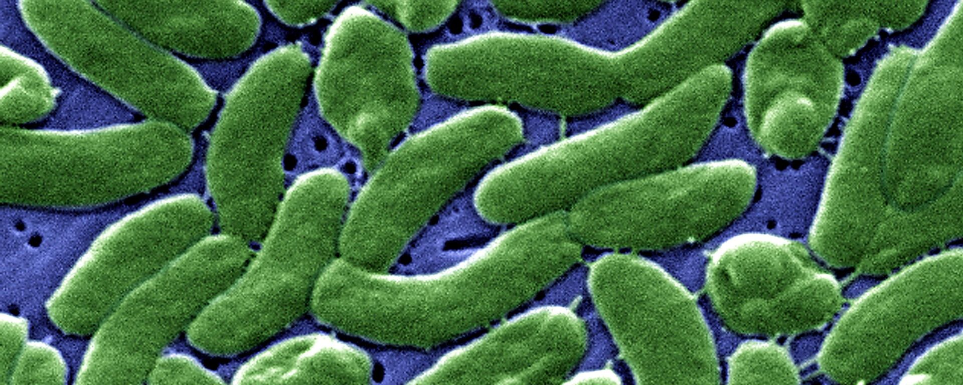 Vibrio Vulnificus - Sputnik Mundo, 1920, 28.09.2023