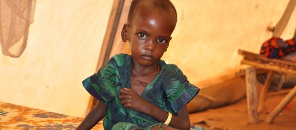 Niño desnutrido en la tienda de campaña de la ONG Médicos Sin Fronteras (MSF) - Sputnik Mundo