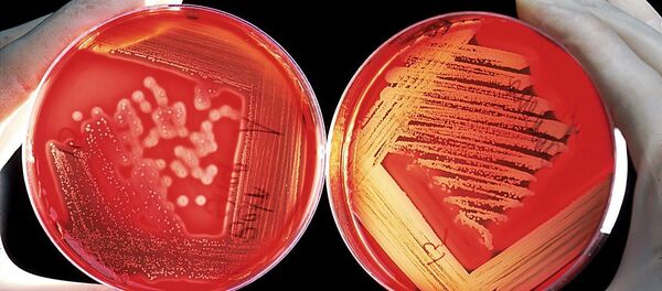 Las células de sangre - Sputnik Mundo