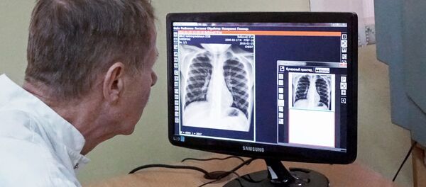 Pulmones (archivo) - Sputnik Mundo