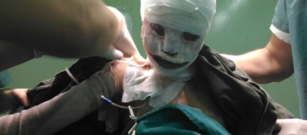 Ahd Al-Khaderi, niña víctima de un incendio en Alepo - Sputnik Mundo