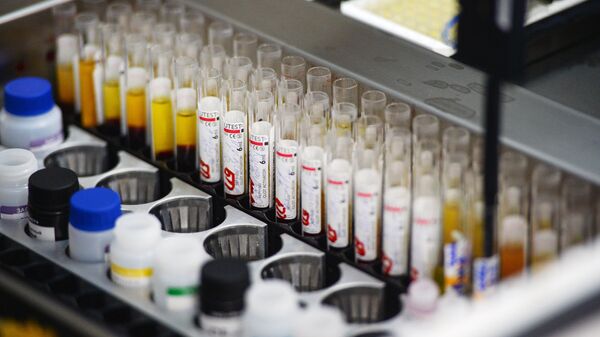 Immunoassay screening lab the blood is tested for infection (hepatitis, syphilis, HIV) on automatic equipment at the Novosibirsk blood donation center - Sputnik Mundo