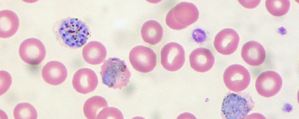 Muestra de sangre - Sputnik Mundo