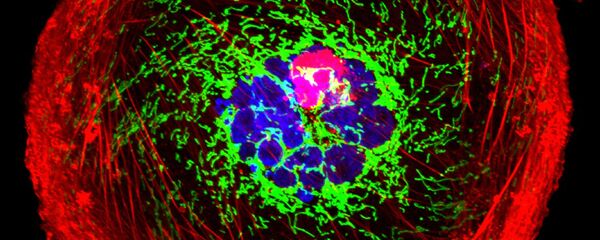 Célula de cáncer - Sputnik Mundo