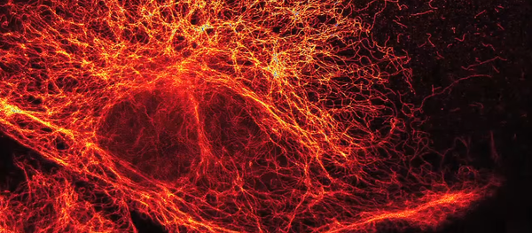 Partículas elementares vistas a través de un súper microscopio de alta resolución Partículas elementares vistas a través de un súper microscopio de alta resolución - Sputnik Mundo