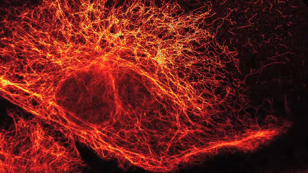 Partículas elementares vistas a través de un súper microscopio de alta resolución Partículas elementares vistas a través de un súper microscopio de alta resolución - Sputnik Mundo