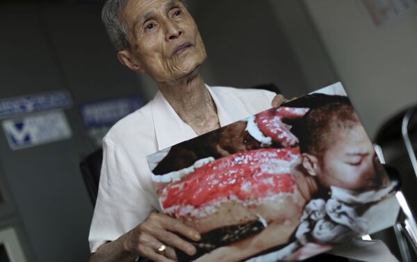 Sumiteru Taniguchi, superviviente del bombardeo atómico sobre Nagasaki ocurrido el 9 de agosto de 1945. La foto fue tomada en enero de 1946 y es hoy día exhibida en el Museo de la Bomba Atómica de Nagasaki, acompañada de las palabras de Taniguchi que dicen: Quiero que usted entienda, aunque sólo sea un poco, el horror de las armas nucleares. - Sputnik Mundo