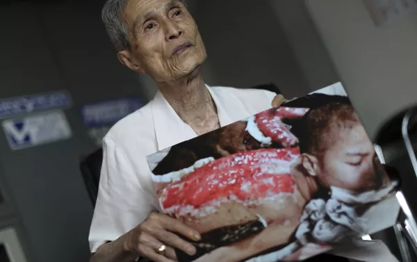 Sumiteru Taniguchi, superviviente del bombardeo atómico sobre Nagasaki ocurrido el 9 de agosto de 1945. La foto fue tomada en enero de 1946 y es hoy día exhibida en el Museo de la Bomba Atómica de Nagasaki, acompañada de las palabras de Taniguchi que dicen: Quiero que usted entienda, aunque sólo sea un poco, el horror de las armas nucleares. Sumiteru Taniguchi, superviviente del bombardeo atómico sobre Nagasaki ocurrido el 9 de agosto de 1945. La foto fue tomada en enero de 1946 y es hoy día exhibida en el Museo de la Bomba Atómica de Nagasaki, acompañada de las palabras de Taniguchi que dicen: Quiero que usted entienda, aunque sólo sea un poco, el horror de las armas nucleares. - Sputnik Mundo