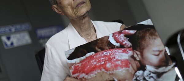 Sumiteru Taniguchi, superviviente del bombardeo atómico sobre Nagasaki ocurrido el 9 de agosto de 1945. La foto fue tomada en enero de 1946 y es hoy día exhibida en el Museo de la Bomba Atómica de Nagasaki, acompañada de las palabras de Taniguchi que dicen: Quiero que usted entienda, aunque sólo sea un poco, el horror de las armas nucleares. - Sputnik Mundo