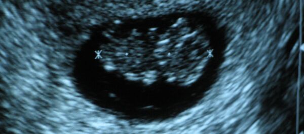 El feto de un bebé - Sputnik Mundo