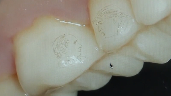 Un ruso se tatúa las caras de Putin y Trump… en sus dientes Un ruso se tatúa las caras de Putin y Trump… en sus dientes - Sputnik Mundo