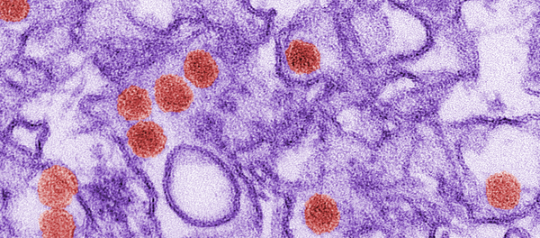 Virus Zika (Archivo) - Sputnik Mundo
