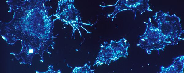 Células cancerígenas (imagen referencial) - Sputnik Mundo