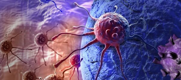 Cáncer (ilustración) - Sputnik Mundo